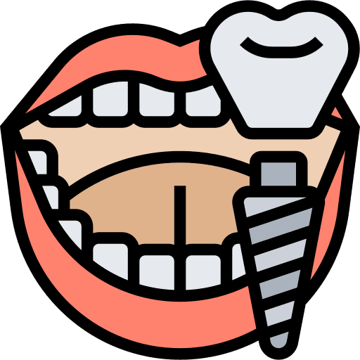 Dental Implants Cost in Delhi