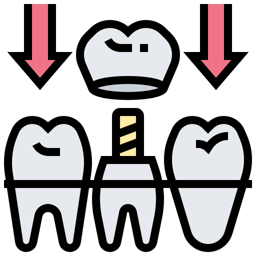 Dental Implants in Delhi