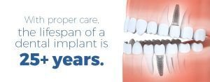 How Long Dental Implants Last