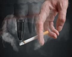 Smoking & Dental Implants