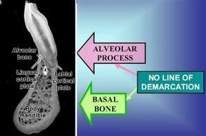 Basal and Alveolar Bone