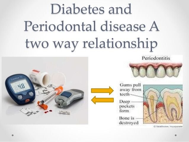 diabetes-and-periodontal-disease