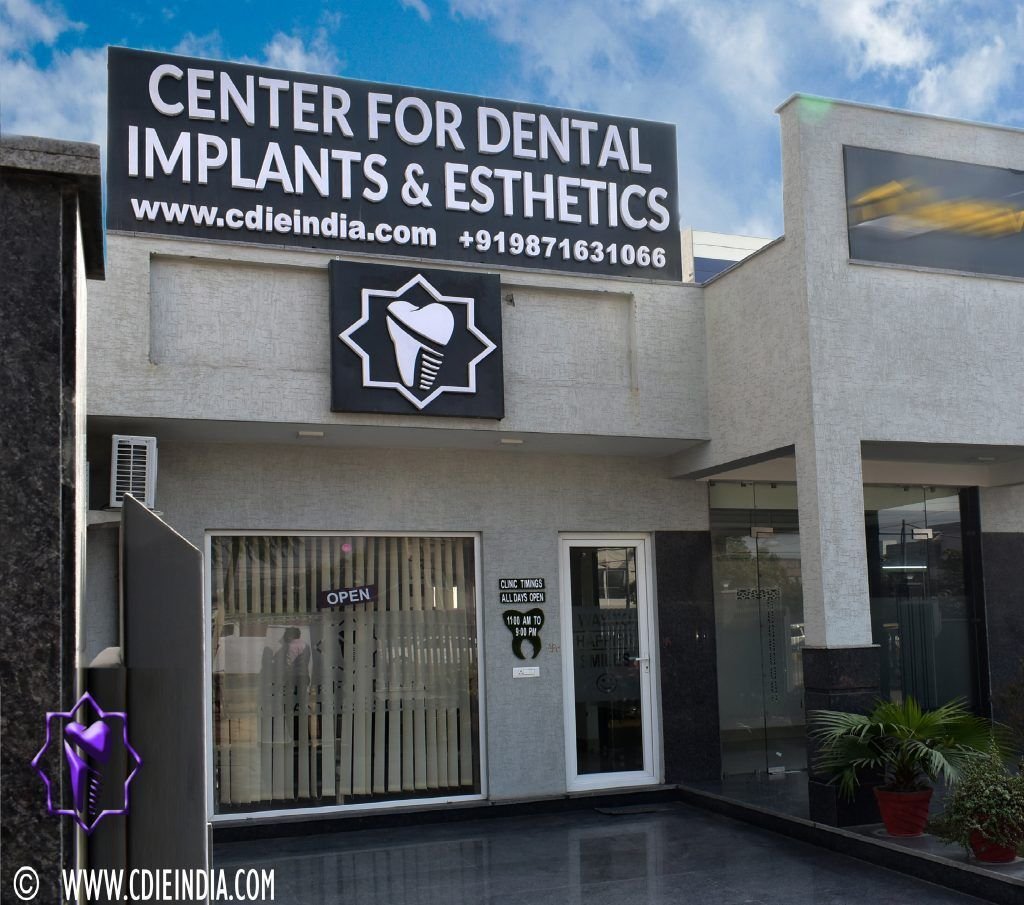 Center for Dental Implants