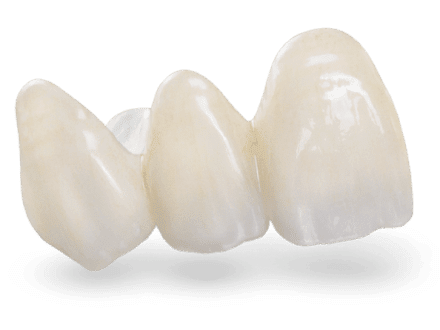 Zirconia Front Teeth Crown Cost
