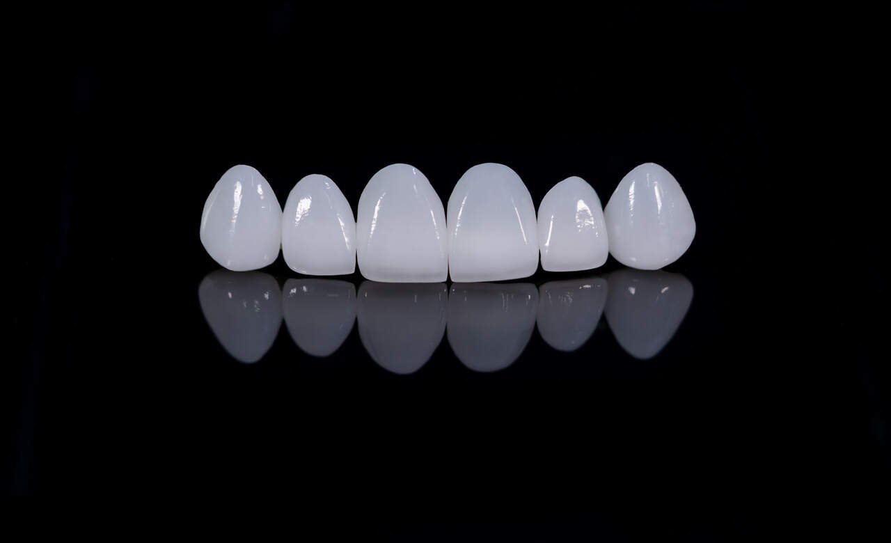 10 Benefits of Zirconia Crown Best Teeth Cap