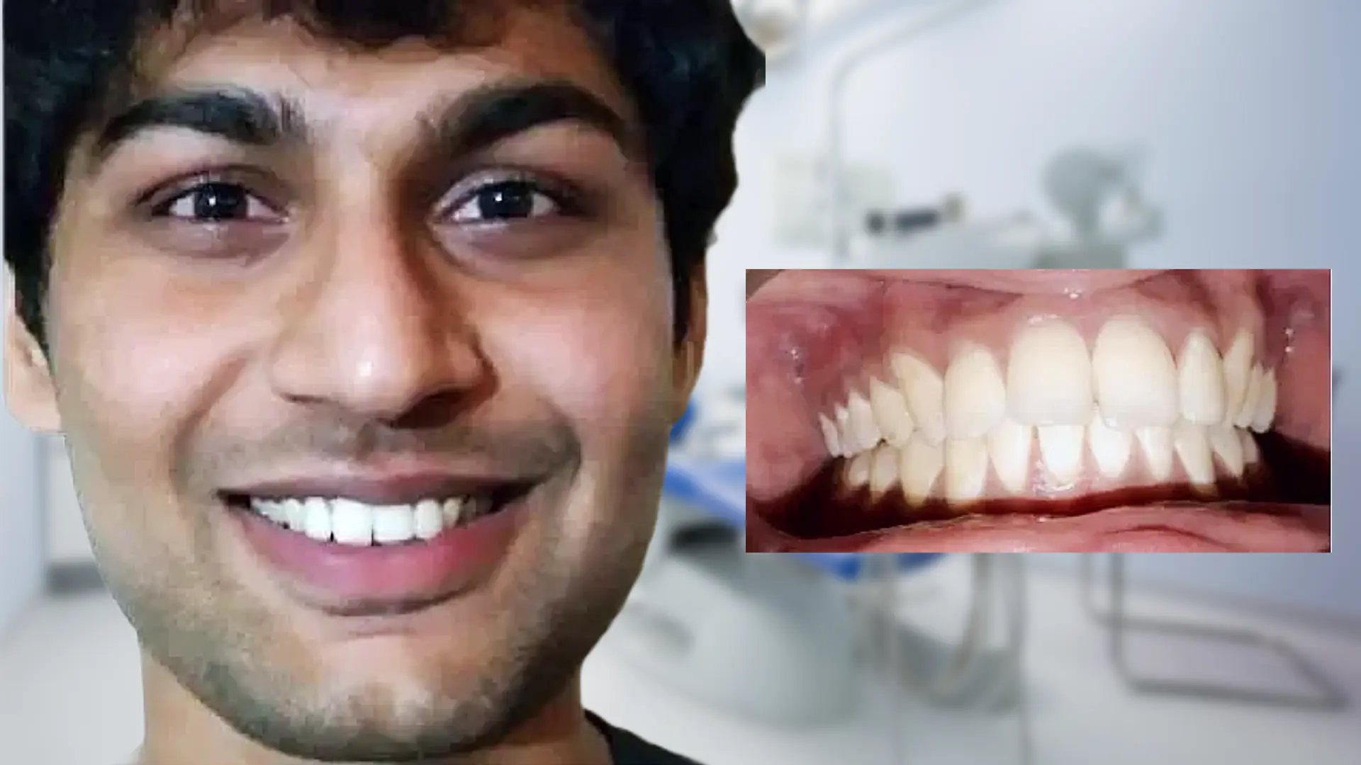 Before treatment - multiple issues
