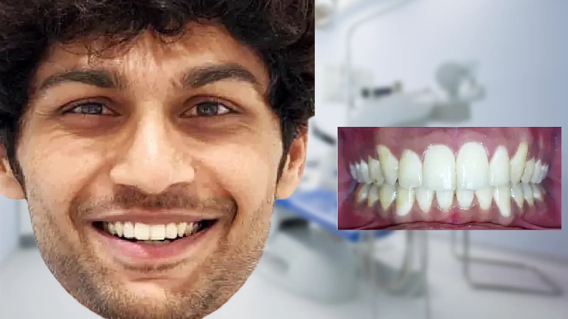 After treatment - beautiful smile