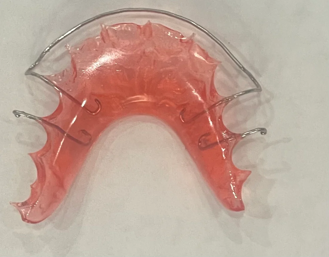 Hawley Retainer - Dental Clinic Gurgaon