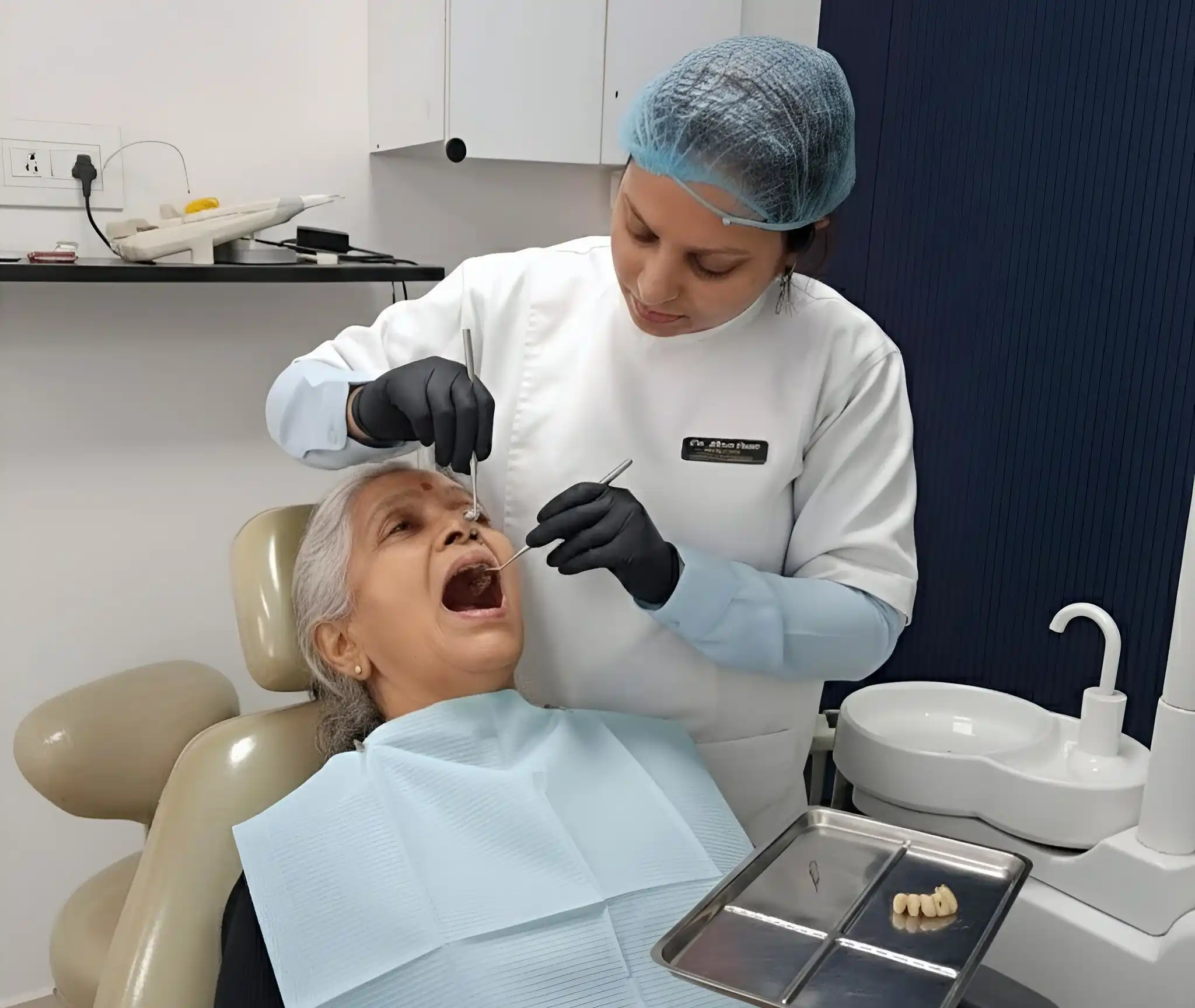 Implant Retained Dental Bridge in Gurgaon