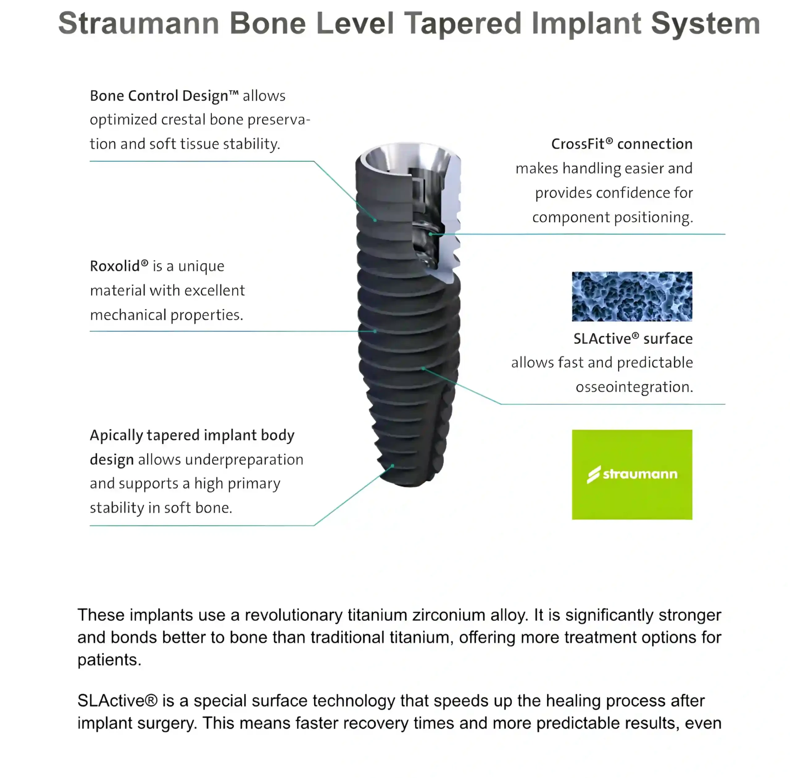 Modern implant technology