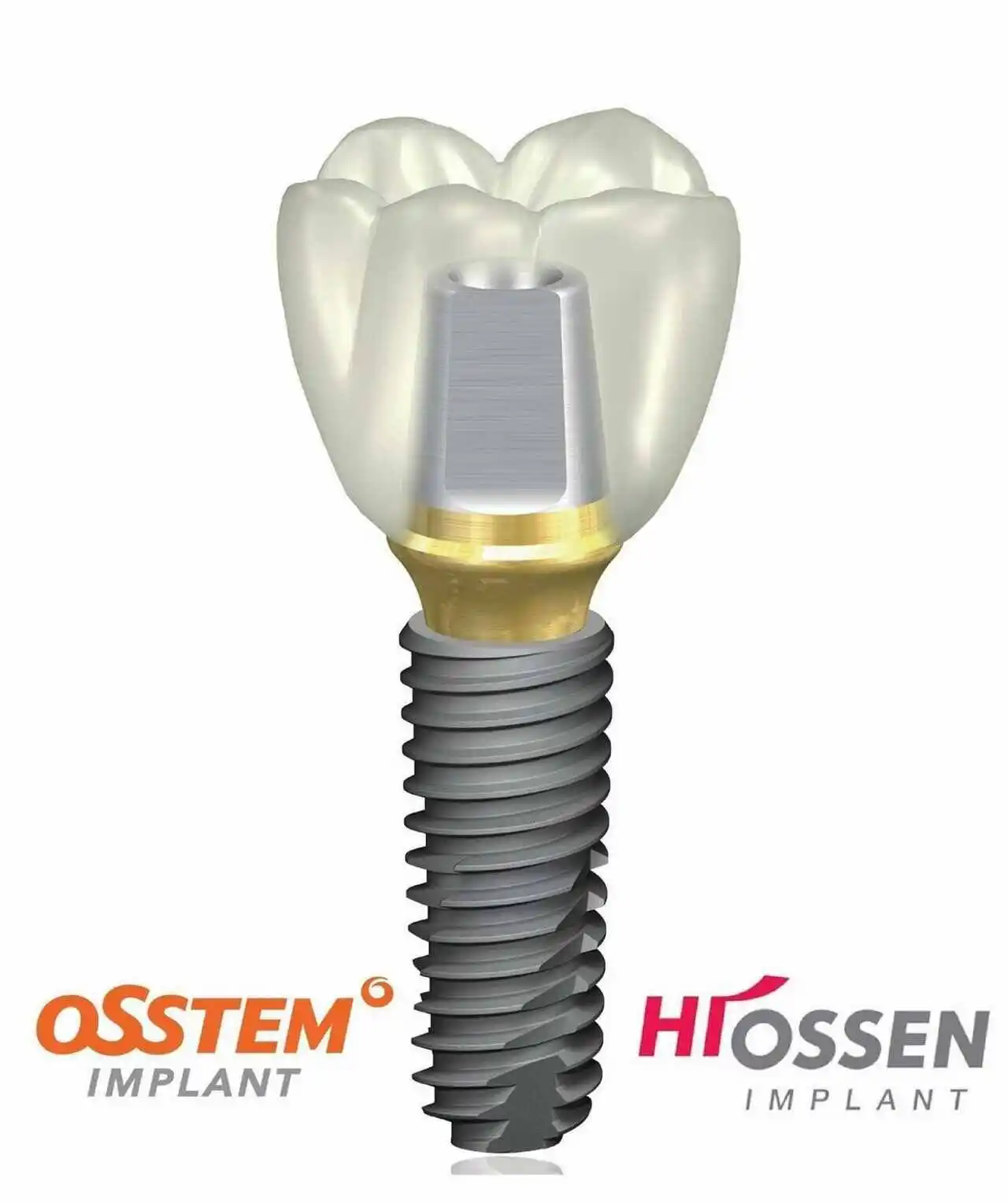 CBCT 3D scan being reviewed before Osstem implant placement at Center for Dental Implants and Esthetics Gurgaon