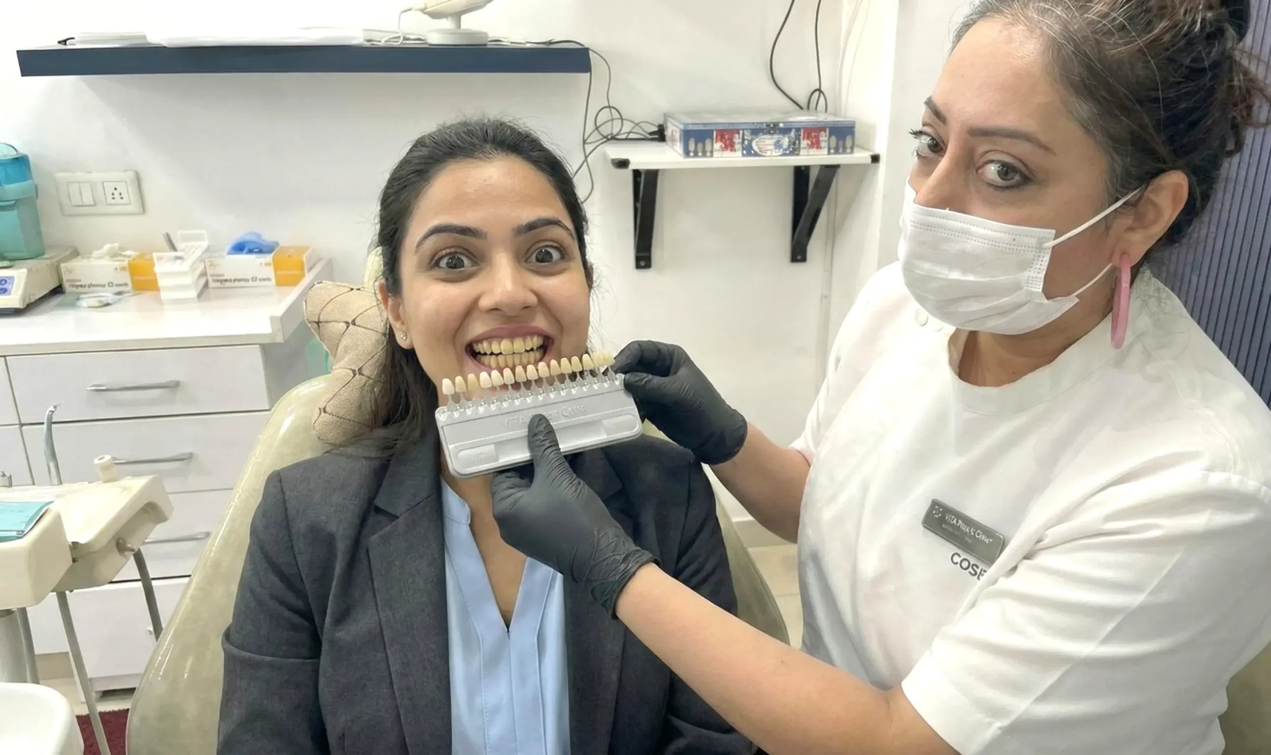 Natural Teeth Whitening Results