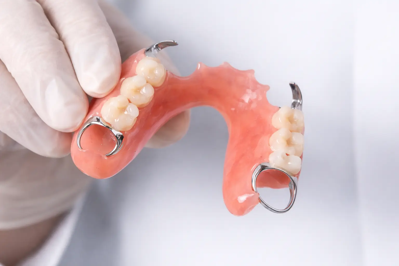 Removable partial denture - missing tooth replacement option