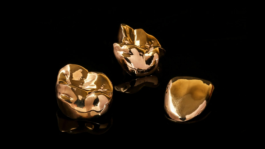 Gold Crown Cost Gurgaon