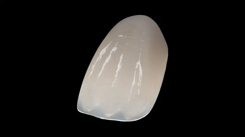 Zirconia dental crown treatment in Gurgaon by prosthodontist Dr Jyoti Singh — dental crown specialist near Artemis Hospital Sector 51