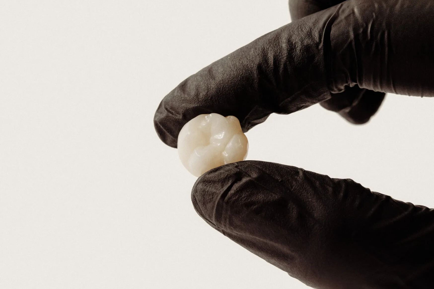 Dental Crown Diagram Gurgaon — types of dental caps explained