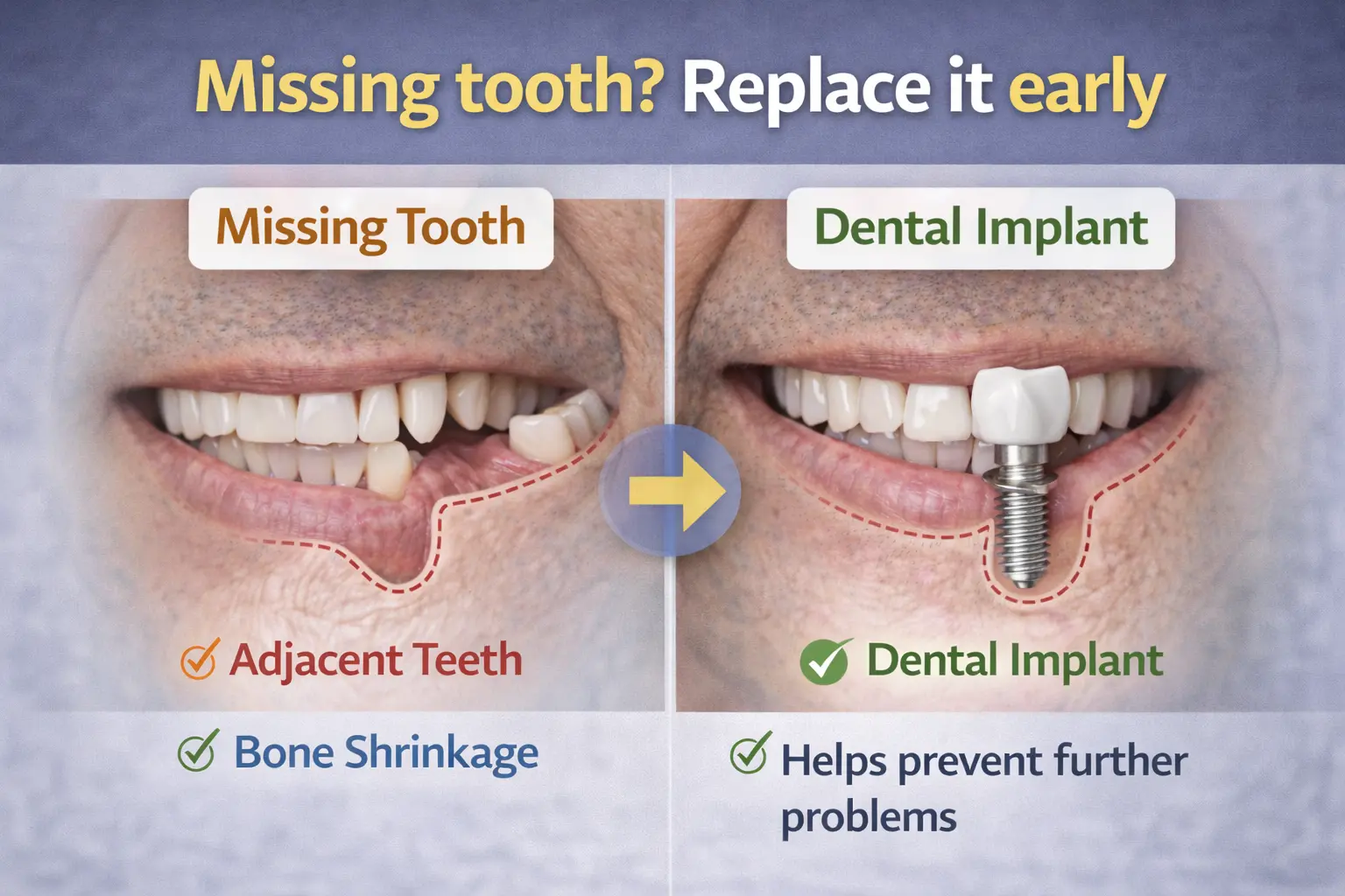Dental implant procedure in Gurgaon at Center for Dental Implants and Esthetics