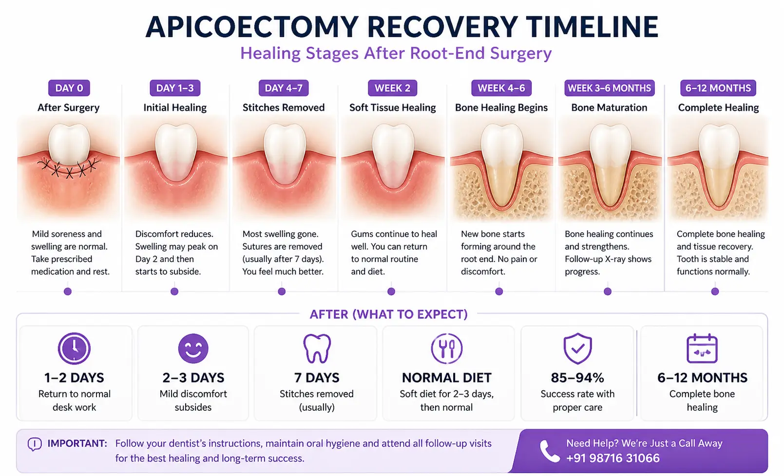 Patient recovery healing timeline after apicoectomy endodontic surgery days and weeks