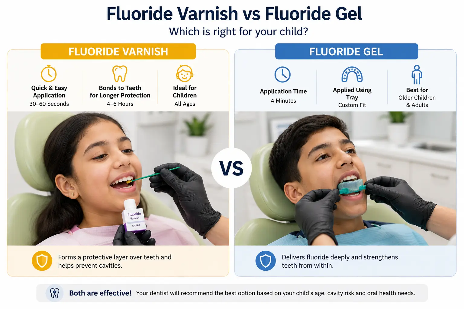 Fluoride varnish vs fluoride gel — professional fluoride treatment at CDIE dental clinic Gurgaon