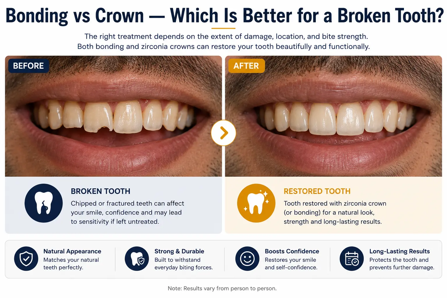 Before and after — zirconia crown placed on broken tooth at CDIE Gurgaon