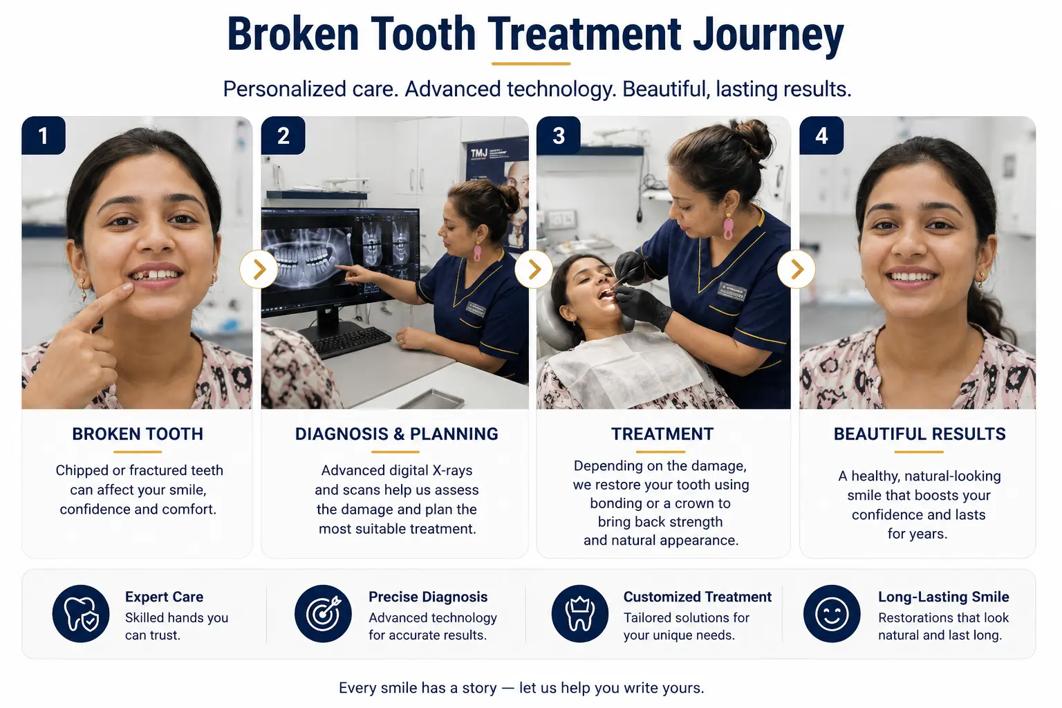 Broken tooth treatment journey at Center for Dental Implants and Esthetics Gurgaon