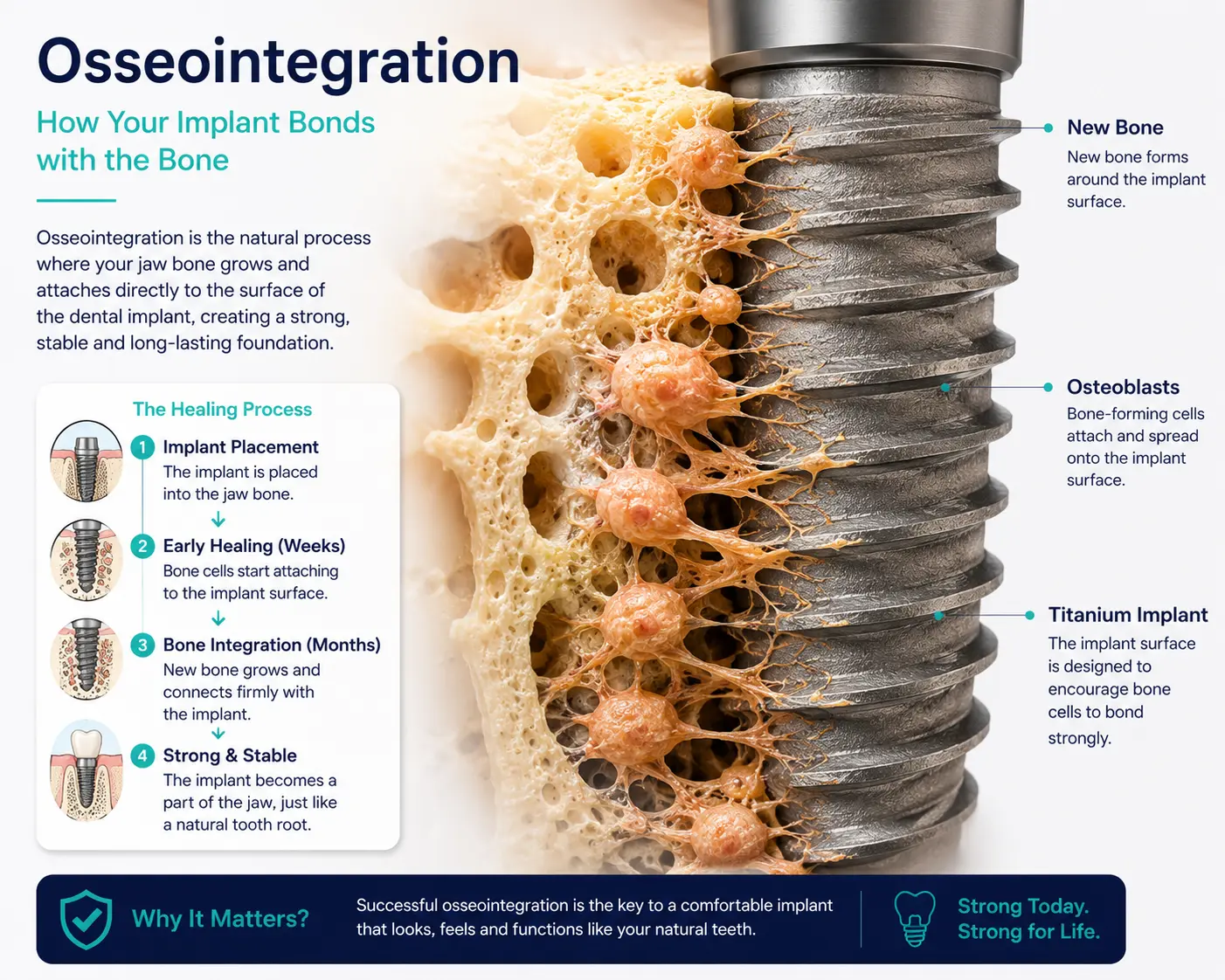 Illustration of osteoblast bone cells attaching to titanium implant surface