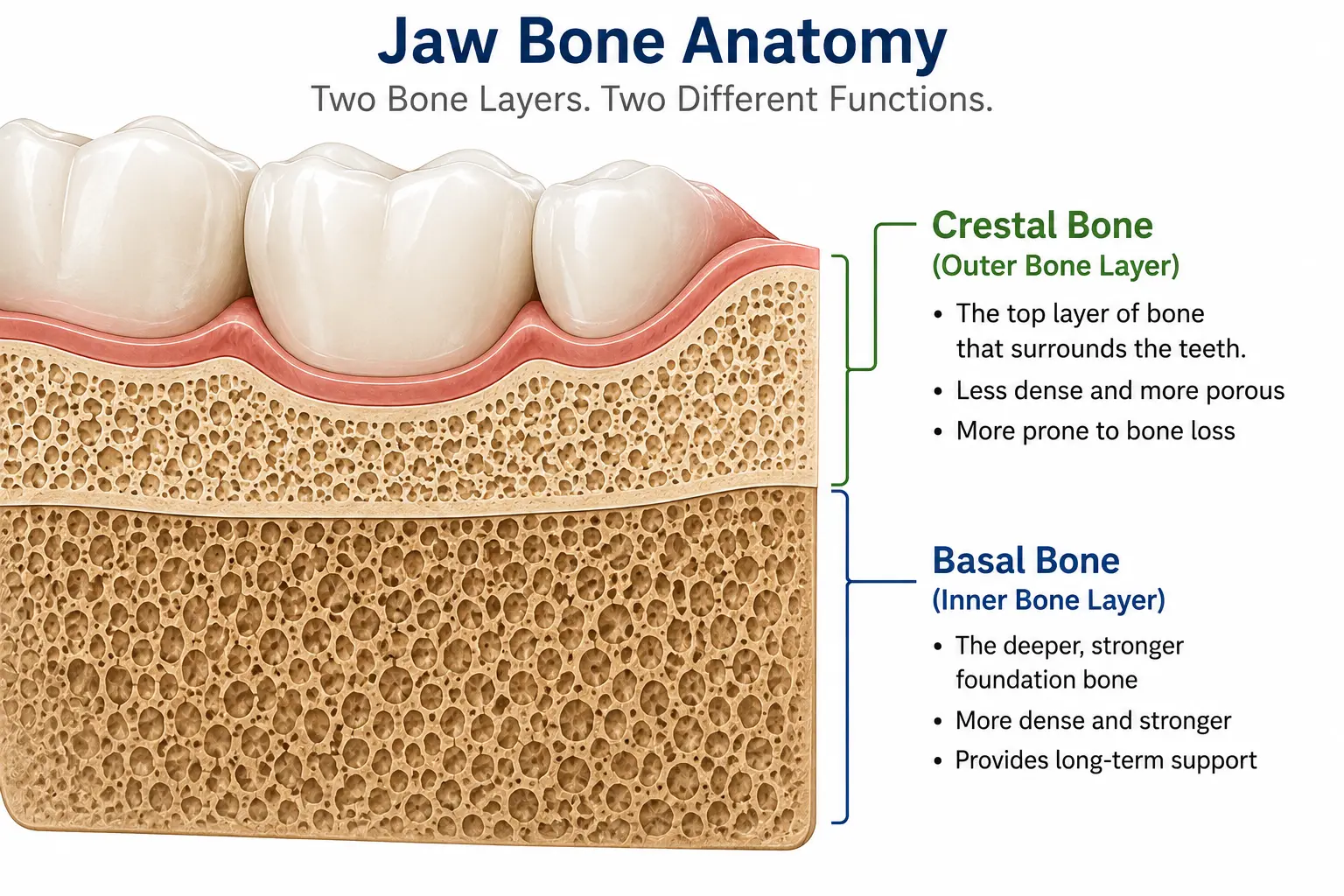 Diagram showing basal bone and crestal bone layers in the jaw